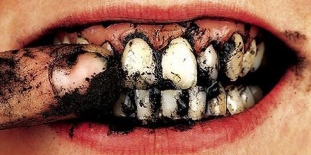 Bu yöntemlerle dişlerinizi beyazlatabilirsiniz