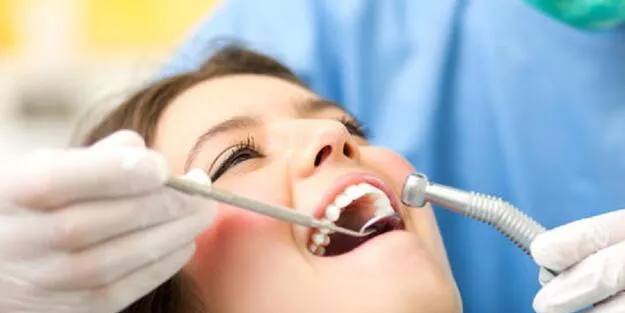 Diş çekiminden sonrası ne yenir, ne içilir? 20 yaş diş çekimi sonrası dikkat edilecek noktalar