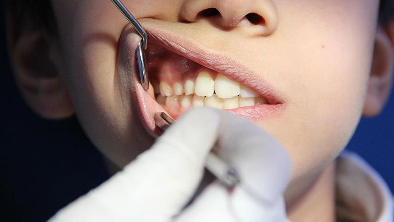 Diş eti kanamaları sadece ağız sağlığı sorunu değil!