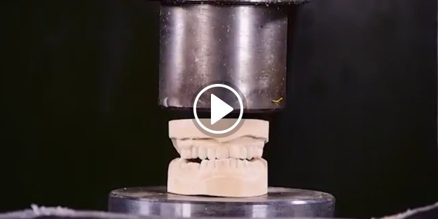 Diş implantı hidrolik presin altında kalırsa