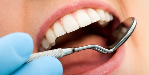 Diş implantından sonra nelere dikkat edilmeli?