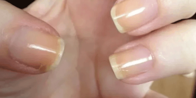 Diş macununuzu tırnağınıza sürerseniz bakın ne oluyor!