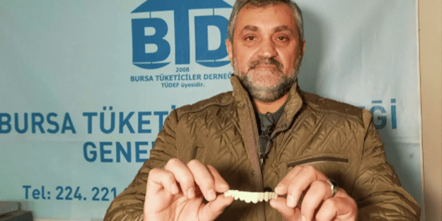 Diş protezi sipariş verdi, bakın ne geldi! İnternet dolandırıcılığı her yerde
