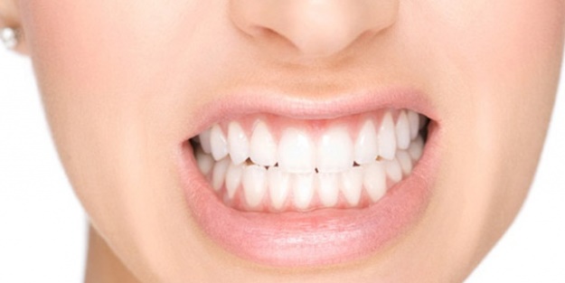 Diş sararmalarına karşı ne yapılmalı?