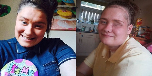 Diş tedavisine gitti, gözünden oldu