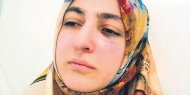'Dişimi acıttın' dedi diş hekimini darp etti!