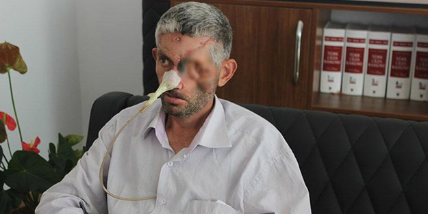 Dişini çektirdikten sonra gözünü kaybetmişti! Valilik, iddialara son noktayı koydu
