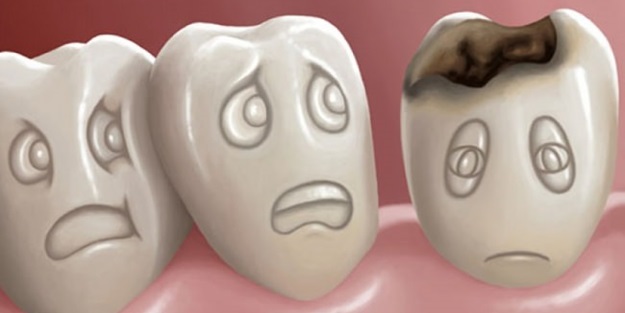 Dişiniz çürükse sakın bunları yapmayın!