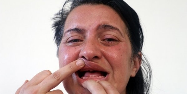 Dişlerini beyazlatmak için gitti, 32 dişinden oldu!