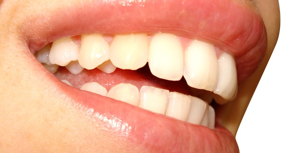 Dişleriniz bembeyaz olsun istiyorsunuz, peki dişleriniz bunun için uygun mu?