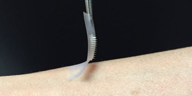 Diyabet hastalarına akıllı bant