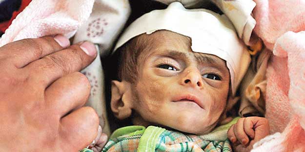 Diyanet ve İHH'dan kampanya! Yemen’e sessiz kalma