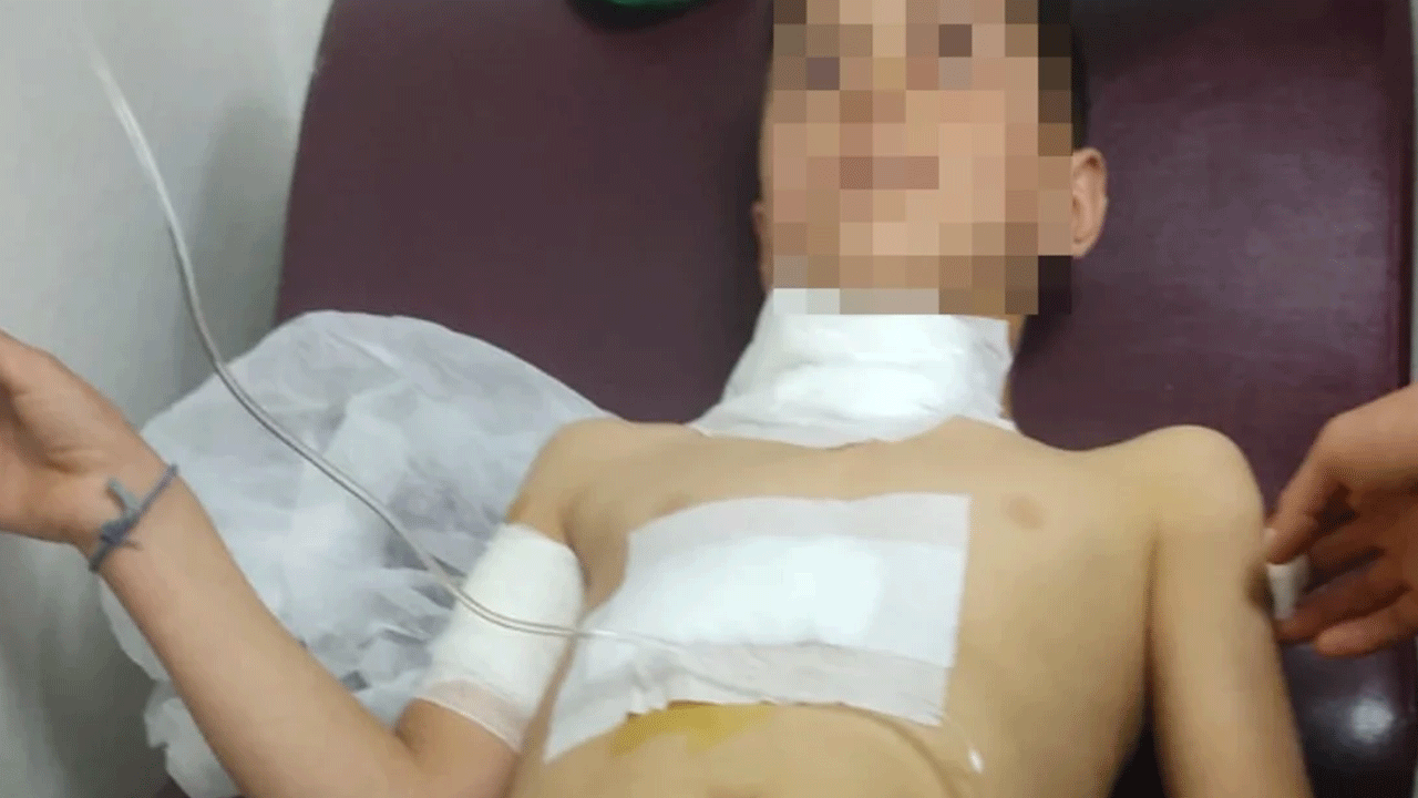 Diyarbakır'da 10 yaşındaki çocuk köpeğin saldırısına uğradı!