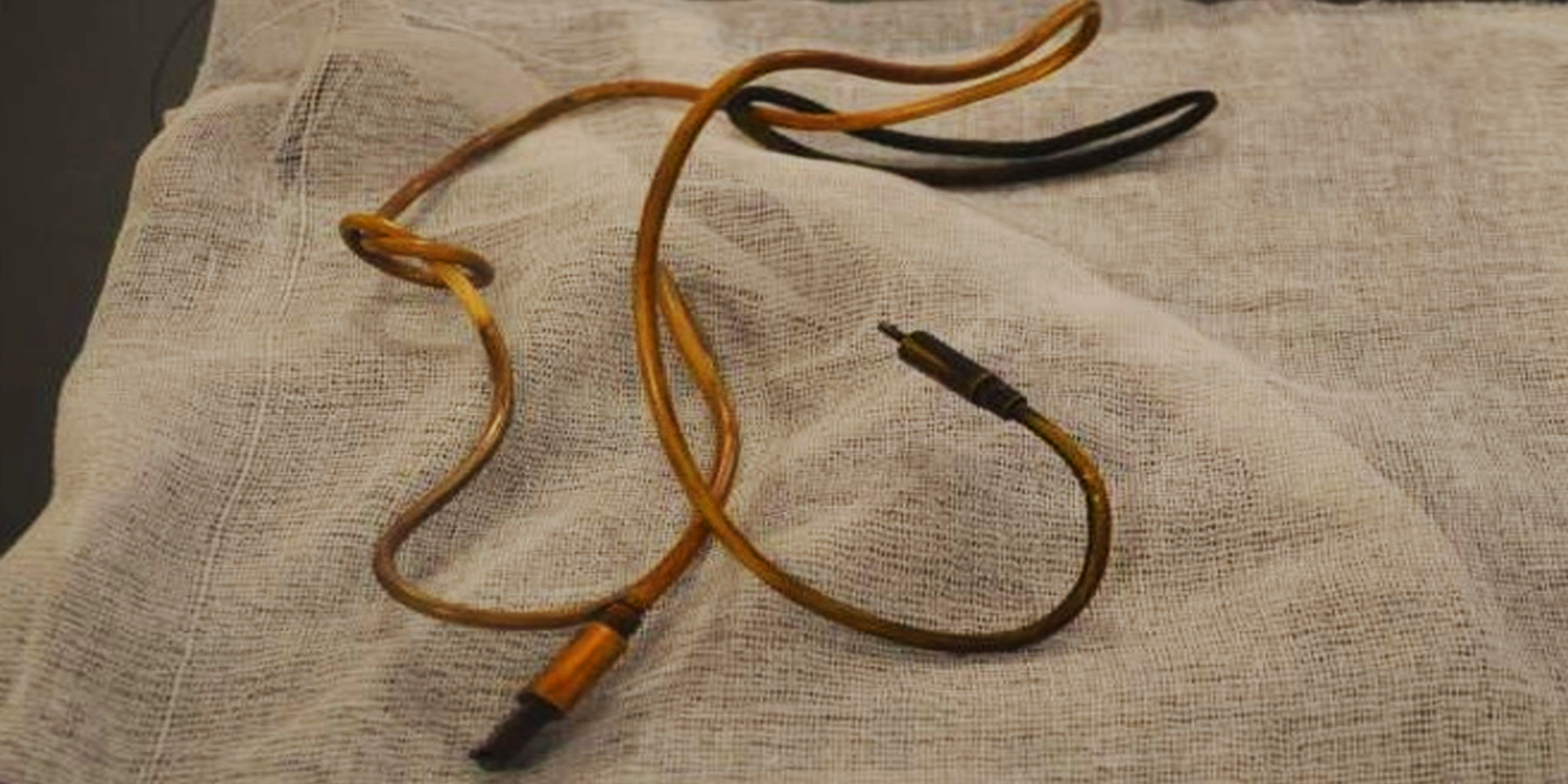 Diyarbakır'da midesinden 1 metrelik şarj kablosu çıktı! Bakın nasıl yutmuş...