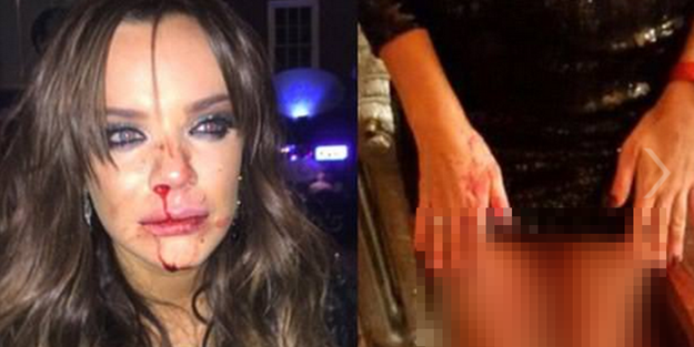 Dizi oyuncusunun gece gezmesi kanlı bitti!