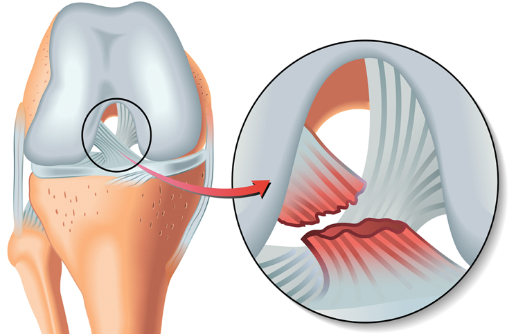 Dizinizden ses geliyorsa...