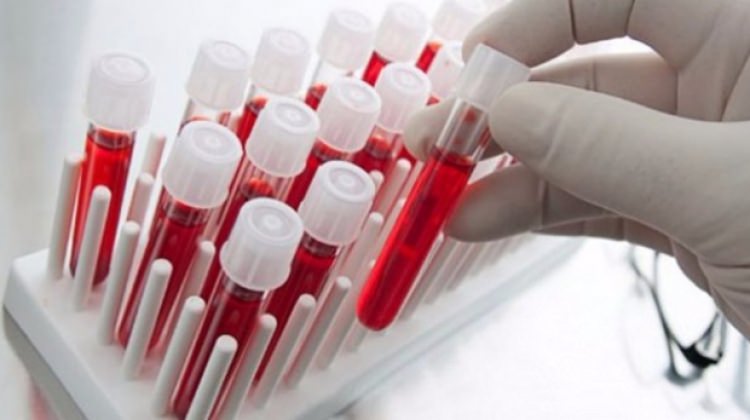 Doç. Dr. Özpolat: Kanser 50 yıl içinde çözülmüş olacak