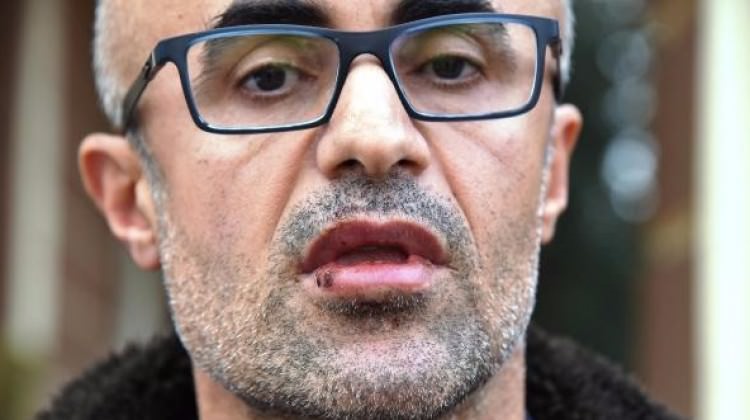 Doçente bayıltan dayak! Öldü sanıp bıraktılar