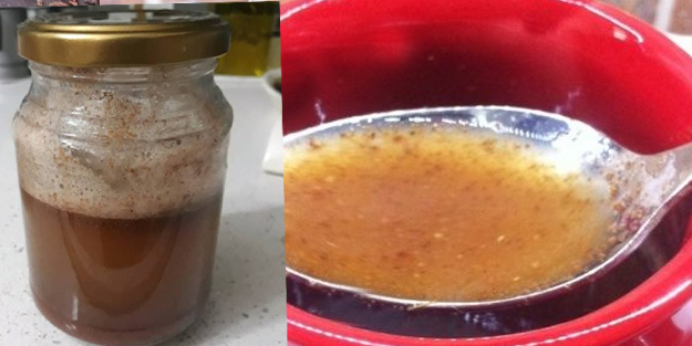 Doğal balgam söktürücü ilaç! Doğal balgam sökme yöntemleri