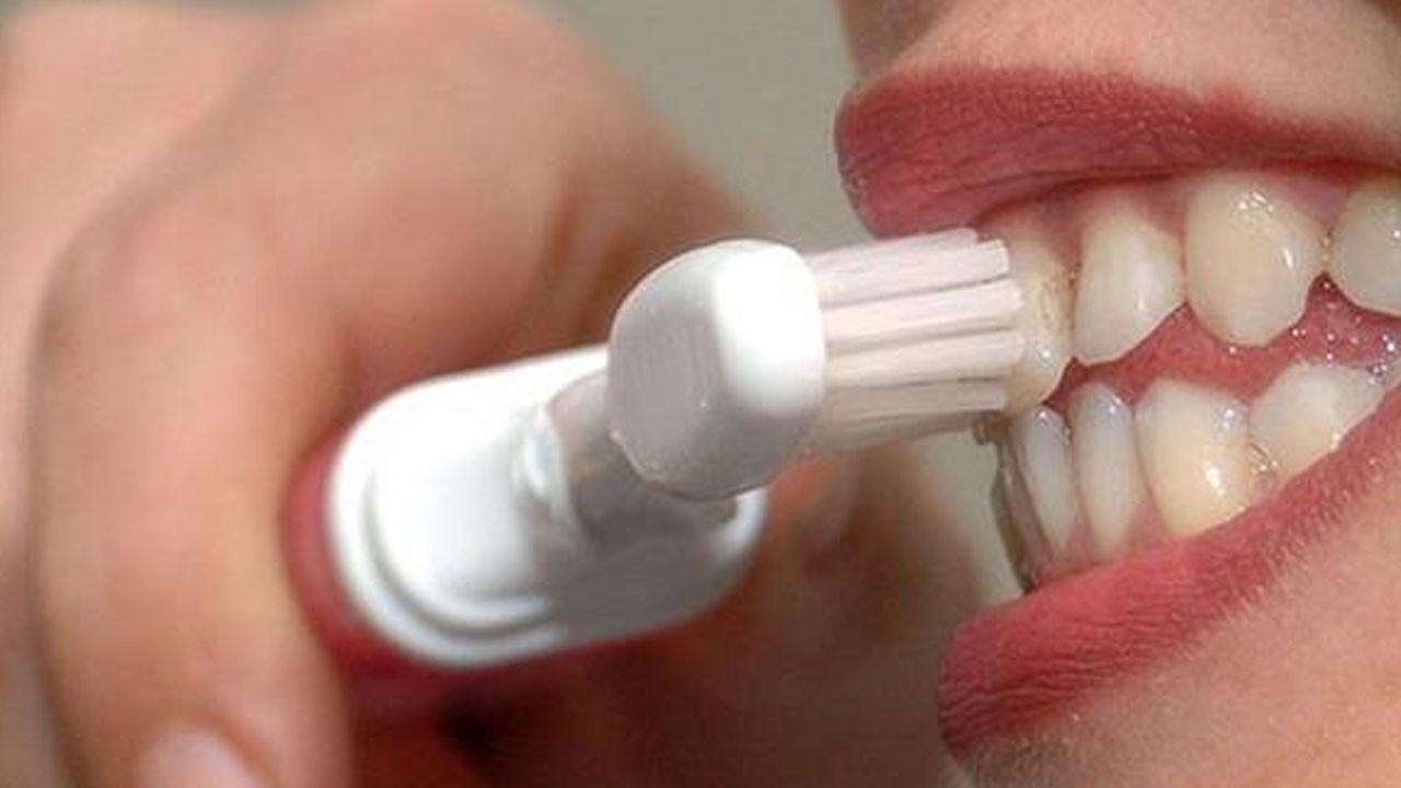 Doğru bilinen yanlışlar! Bembeyaz olsun derken diş sağlığınızdan olmayın!