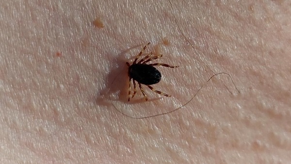 Doğu Karadeniz'de kene vakası var mı?