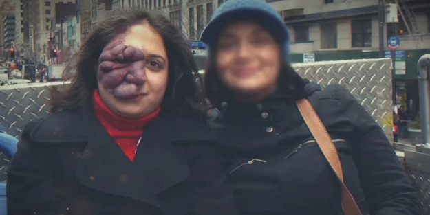 Doğum lekesi! Sözlerini hatırlattı: yüzünden bir gözünde görme kaybı oluşan bir kadının hikayesi