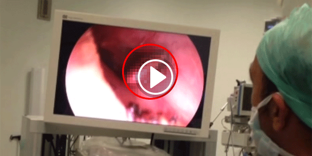 Antalya'da kene vakası