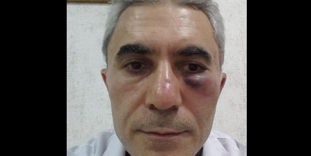 Doktor, tartıştığı meslektaşını darbetti