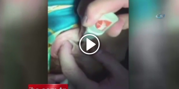 Genç kızın kulağından çıkan görenleri şoke etti!