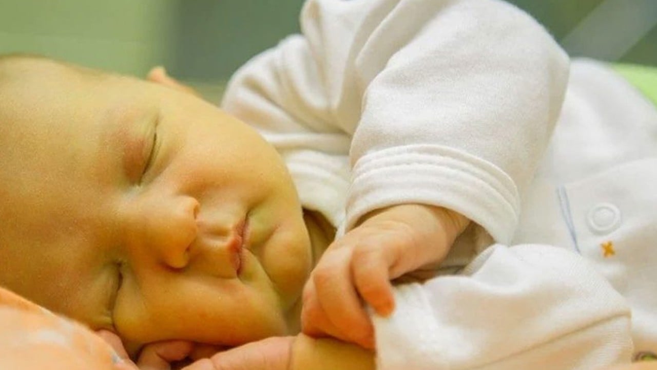 Doktora göre sarılık doğal bir süreç: Ne zaman tehlikeli haber geldi! Çözümü için önerdiği formül neler?