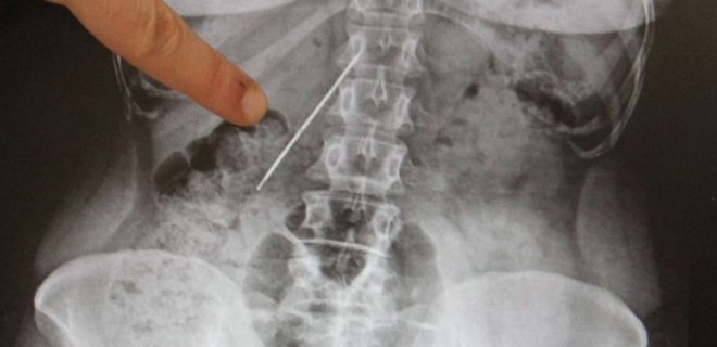 Doktorlar almaya cesaret edemedi! Tam 26 yıl böyle yaşadı