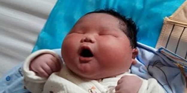 Doktorlar bile kilosuna şaştı!