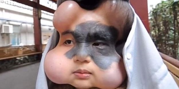 Doktorlar genç kızı bu hale getirdi