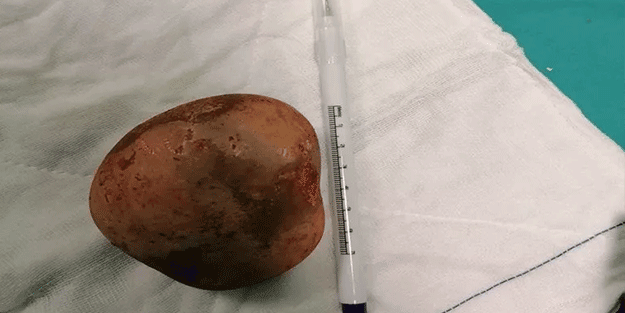 Doktorlar gördüklerine inanamadı