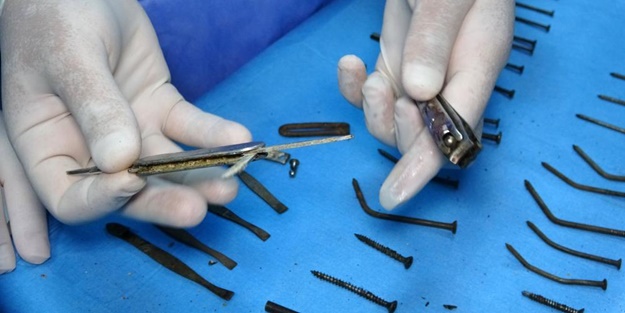 Doktorlar gözlerine inanamadı... Hepsi midesinden çıktı