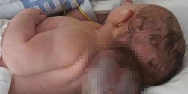 Doktorlar hayrete düştü! - FOTO