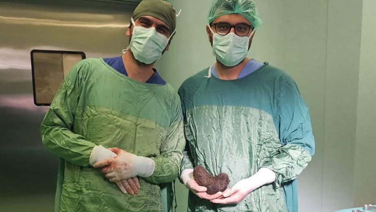 Doktorlar şaştı kaldı! 9 yaşındaki çocuğun midesinden çıkan pes dedirtti