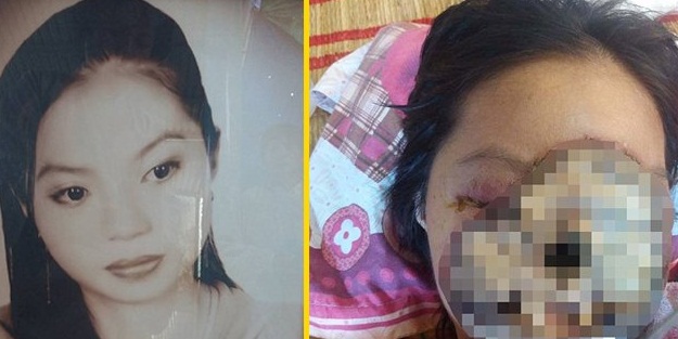 Doktorlar sinüzit dedi ama...