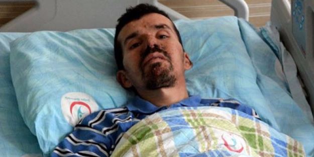 Doktorları bile şaşırttı! Tam 35 santim çapında