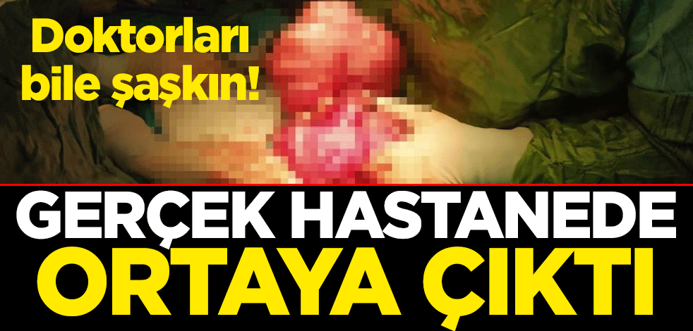 Doktorları bile şaşkın! Gerçek hastanede ortaya çıktı