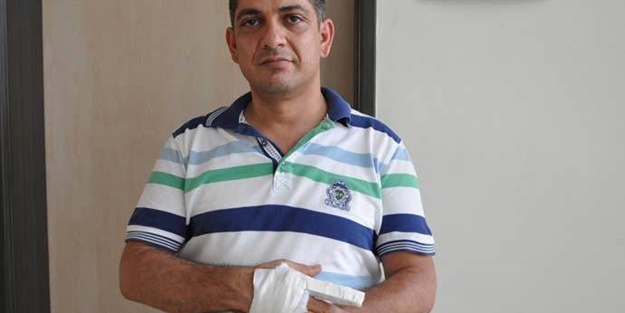 Doktorun parmağını kırdı!