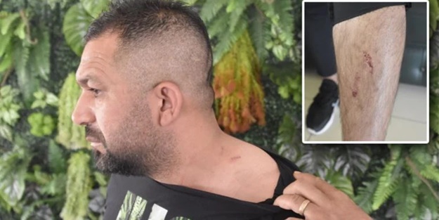 Doktorun şehit kardeşini darbettiği iddiası