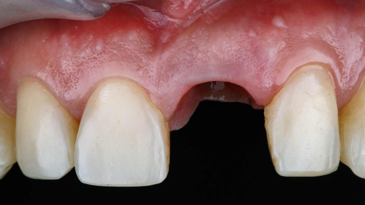 Dökülen dişleri her yaşta yeniden çıkartan ilaç yapıldı! Ne zaman satışa çıkacak?