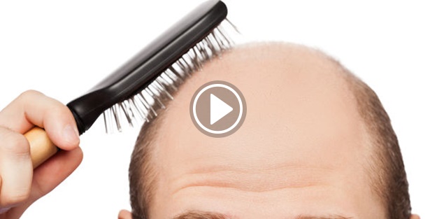 Dökülen saçlar geri gelir mi?