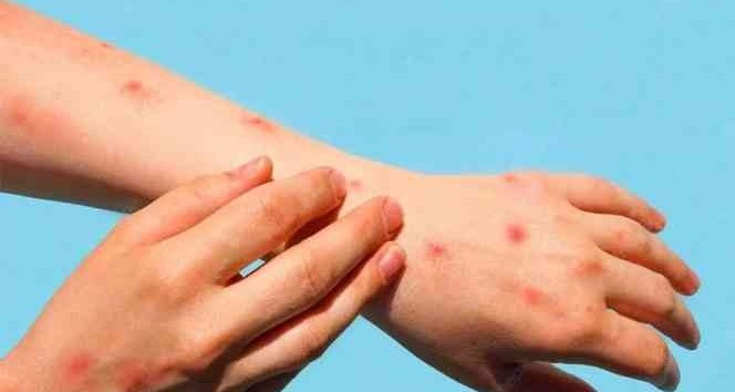 “Domates gribinin kontrol altına alınması zor görünüyor”