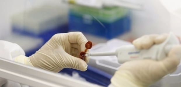  Domuz gribi tedavisi gören öğretmen hayatını kaybetti