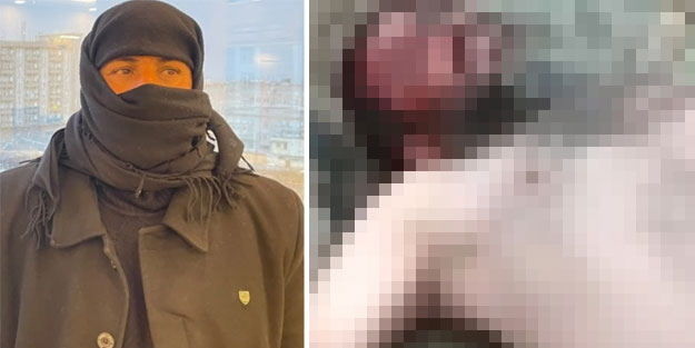 Dövülüp teşhir edildi... Şimdi evden çıkamıyor