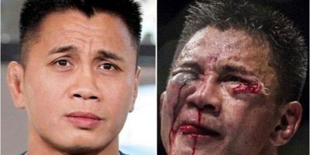 Dövüşçülerin maç sonu halleri - FOTO