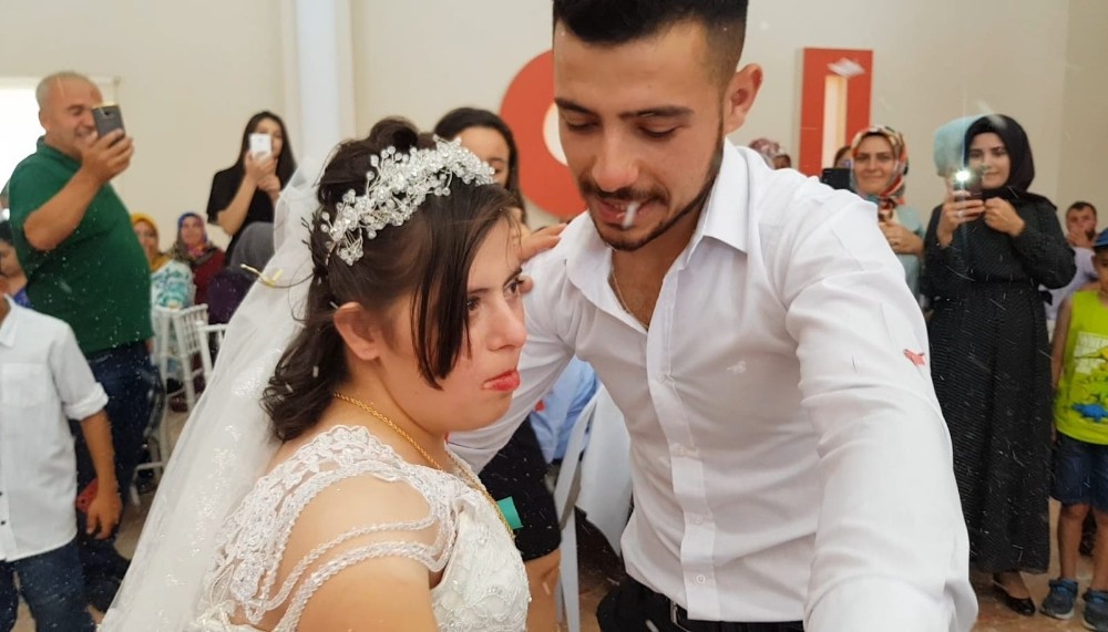 Down sendromlu Rabia’ya damatsız düğün 