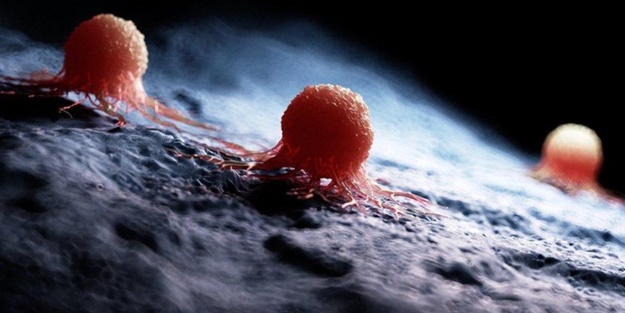 DSÖ en sık görülen kanser türünü açıkladı